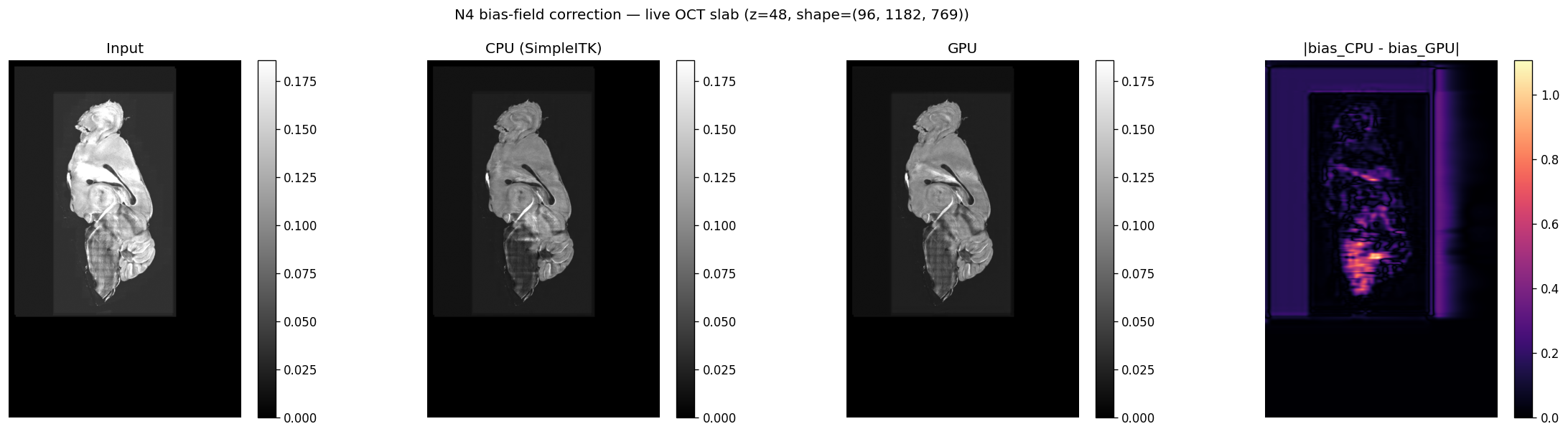 CPU vs GPU N4 on live OCT slab